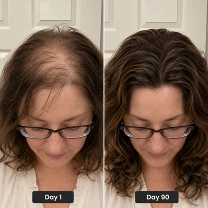 Rosemary & Fermented Rice Water Follicle Recovery Serum